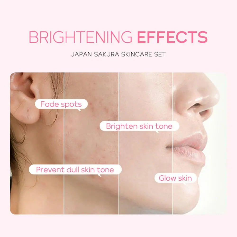 Coffret de soins pour le visage Crème nettoyante Sakura Essence Tonique hydratant blanchissant et anti-âge Crème pour les yeux Sérum pour le visage Soins de la peau pour les yeux