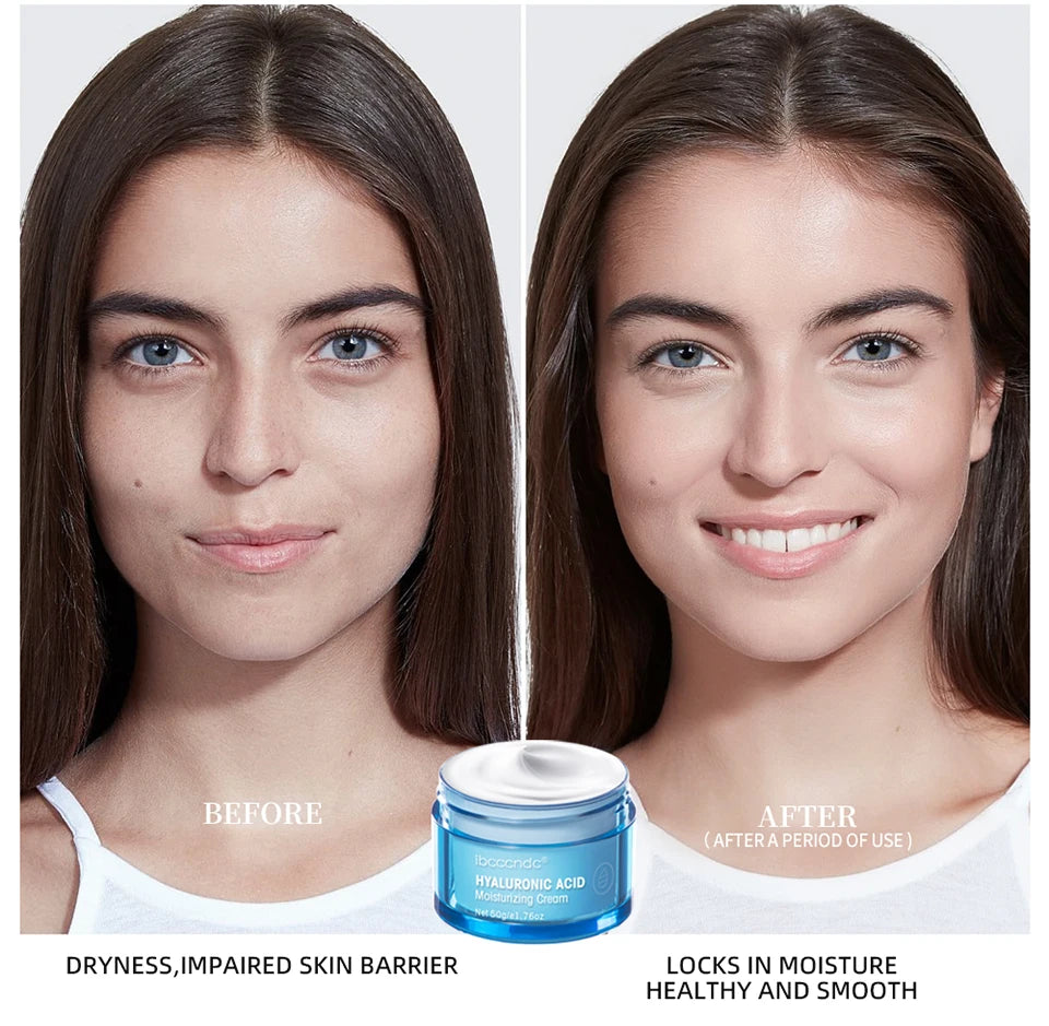 Crème Gel à l'acide hyaluronique, hydratante pour le visage, pour hydrate et lisse, peau Extra sèche, nourrissante, améliore la sécheresse, Lotion pour le visage