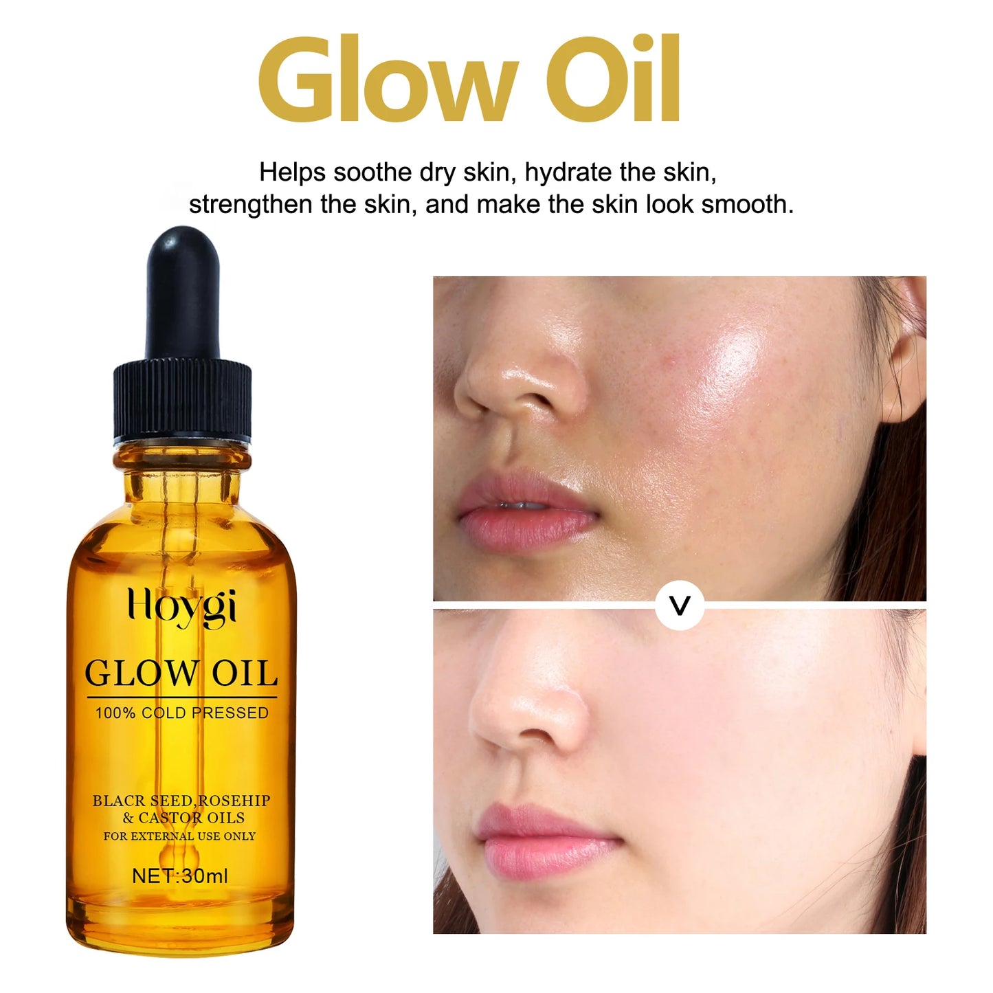 Huile pour le visage Anti-âge traitement du visage hydratant réducteur de rides pour peau sèche huile de rose musquée éclaircissante 30ml Non grasse