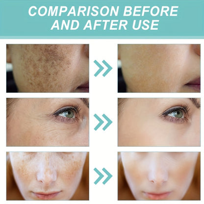 Dark Spot Correcting Cream And Honey Face Cream, Hyaluronic Acid, Niacinamide, Retinol Moisturize And Nourish To Lighten Skin Discoloration And Melanin, Rejuvenate, Brighten And Whiten The Skin, Day And Night Watery Face Crea
