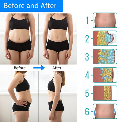 Cryothérapie dissoudre les graisses thérapie par le froid masseur Anti-Cellulite Machine de congélation Lipo abdominale perte de graisse corps minceur Criolipolisis